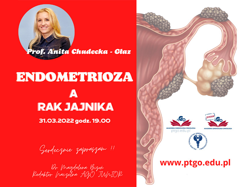 Endometrioza A Rak Jajnika Webinar Polskie Towarzystwo Ginekologii